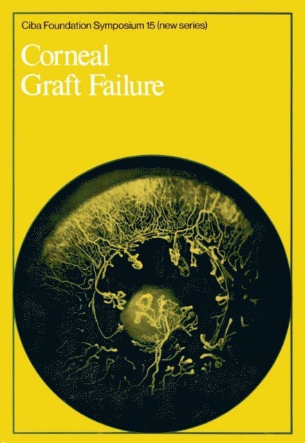 Julie Knight, Ruth Porter - Corneal Graft Failure, E-bok