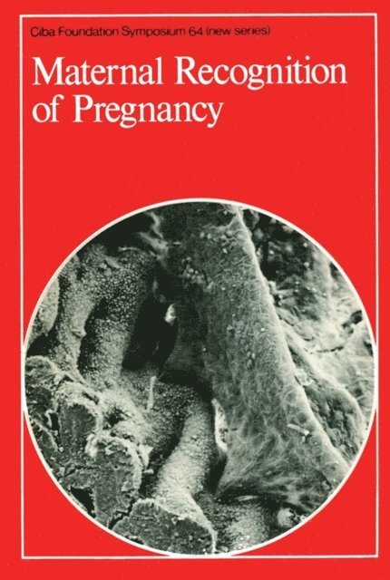 Julie Whelan - Maternal Recognition of Pregnancy, E-bok