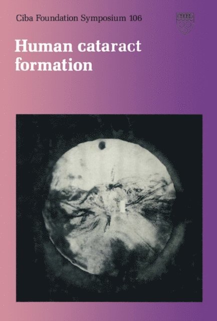 Julie Whelan, Jonathan Nugent - Human Cataract Formation, E-bok
