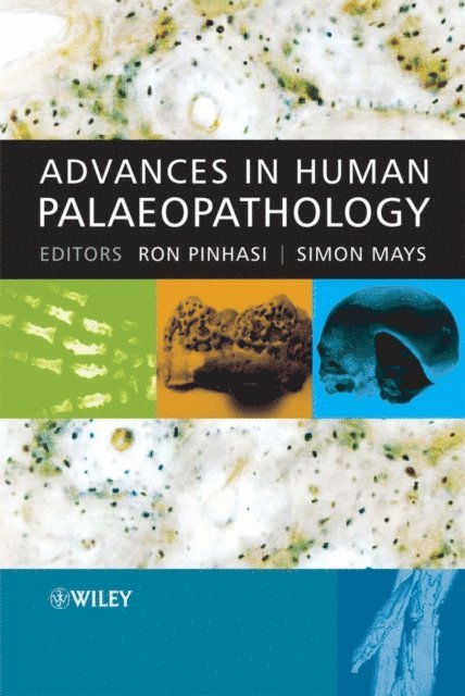 Simon Mays, Ron Pinhasi - Advances in Human Palaeopathology, E-bok