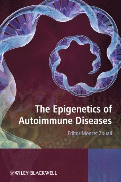 Epigenetics of Autoimmune Diseases