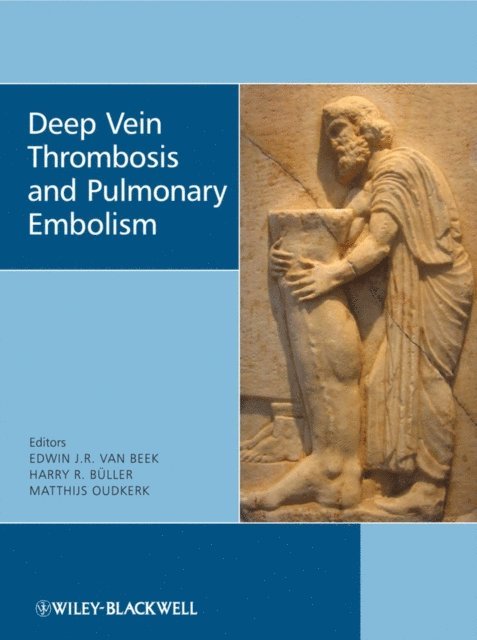 Matthijs Oudkerk, Harry R. B ller, Edwin J. R. van Beek - Deep Vein Thrombosis and Pulmonary Embolism, E-bok