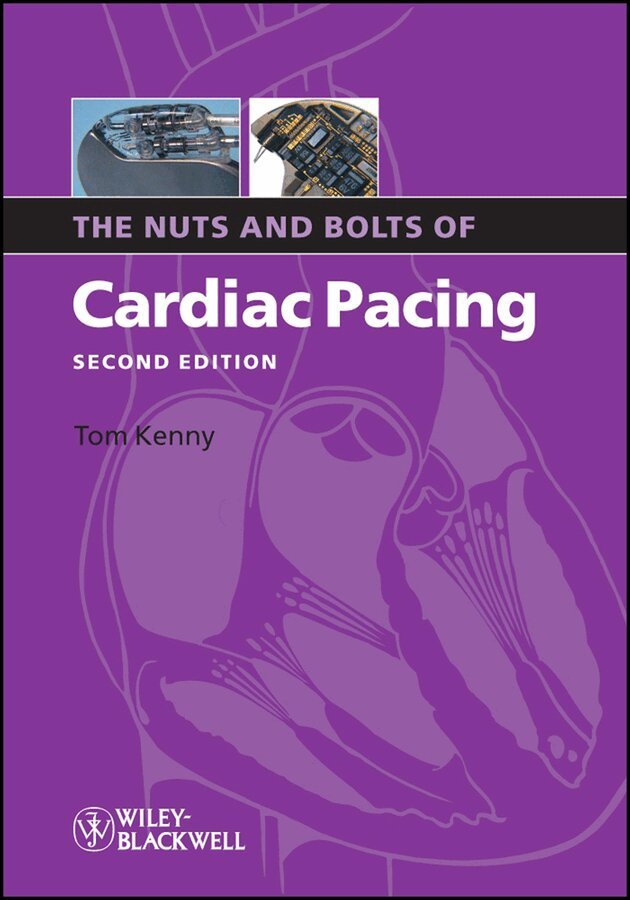 Tom Kenny - Nuts and Bolts of Cardiac Pacing. Tillgänglighet: Tillfälligt slut
