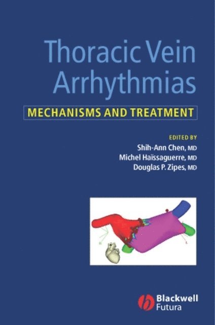 Douglas Zipes, Michel Ha ssaguerre, Shih-Ann Chen - Thoracic Vein Arrhythmias, E-bok