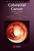 Challenges in Colorectal Cancer