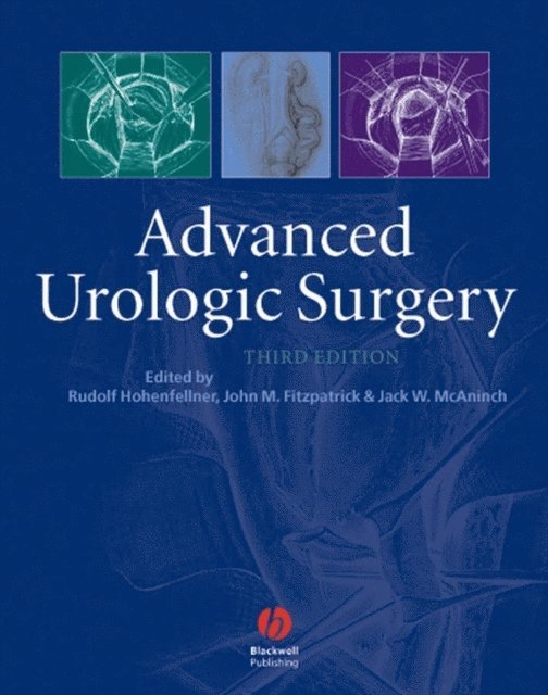 Jack McAninch, John W. Fitzpatrick, Rudolph Hohenfellner - Advanced Urologic Surgery, E-bok