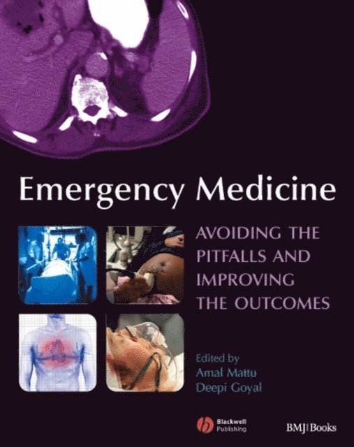 Deepi G. Goyal, Amal Mattu - Emergency Medicine, E-bok