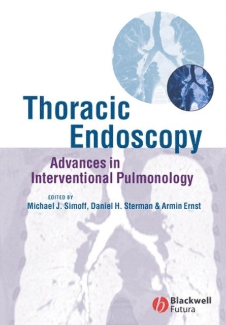 Armin Ernst, Daniel H. Sterman, Michael J. Simoff - Thoracic Endoscopy, E-bok