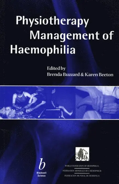 Physiotherapy Management of Haemophilia