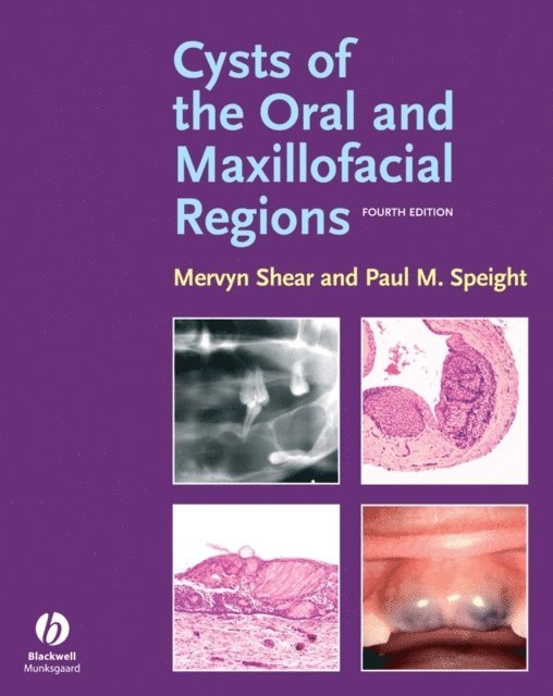 Paul M. Speight, Mervyn Shear - Cysts of the Oral and Maxillofacial Regions, E-bok