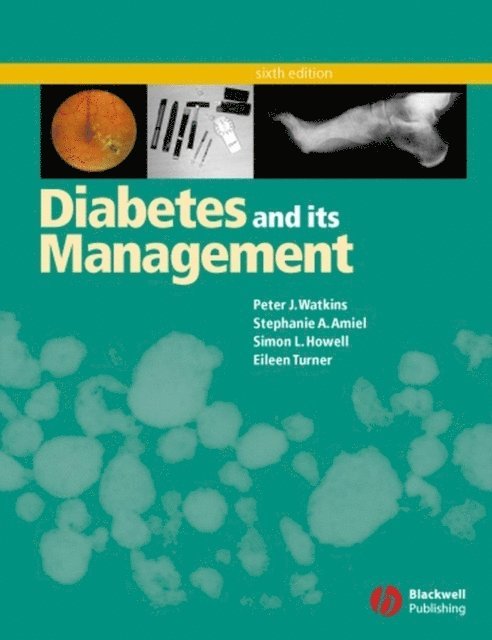 Eileen Turner, Simon L. Howell, Stephanie A. Amiel, Peter J. Watkins - Diabetes and Its Management, E-bok. Tillgänglighet: Lägg i varukorg