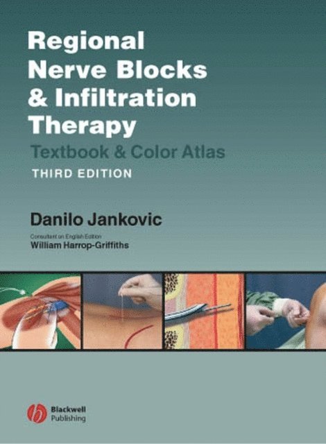 Danilo Jankovic - Regional Nerve Blocks And Infiltration Therapy, E-bok