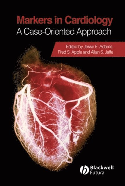 Allan S. Jaffe, Fred S. Apple, Jesse E. Adams - Markers in Cardiology, E-bok