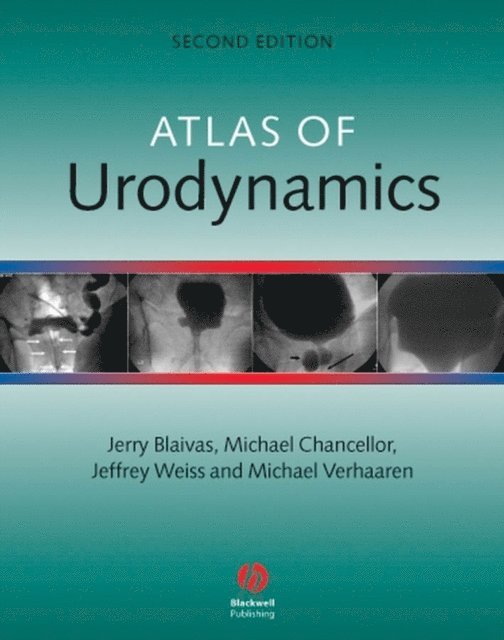 Michael Verhaaren, Jeffrey Weiss, Michael Chancellor, Jerry G. Blaivas - Atlas of Urodynamics, E-bok