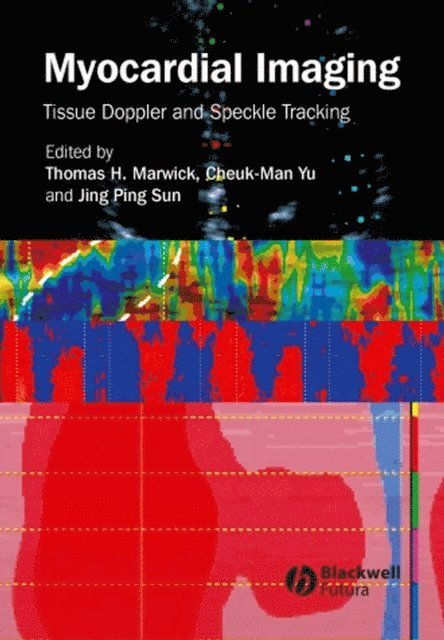 Jing Ping Sun, Cheuk-Man Yu, Thomas H. Marwick - Myocardial Imaging, E-bok