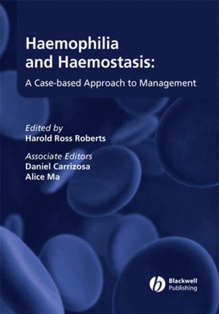 Harold R. Roberts - Haemophilia and Haemostasis, E-bok. Tillgänglighet: Lägg i varukorg