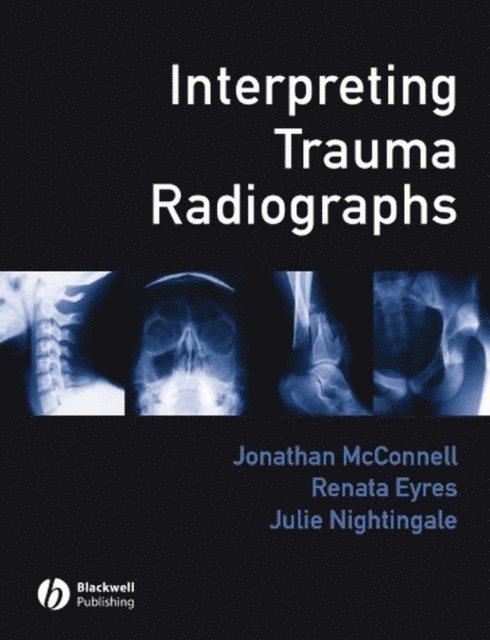 Julie Nightingale, Renata Eyres, Jonathan McConnell - Interpreting Trauma Radiographs, E-bok