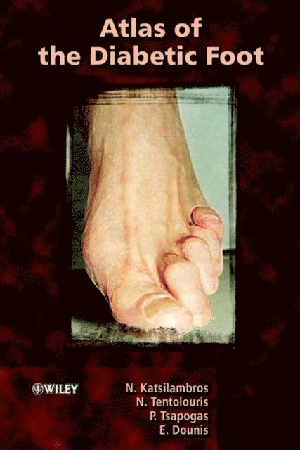 Eleftherios Dounis, Panagiotis Tsapogas, Nicholas Tentolouris, Nikolaos Katsilambros - Atlas of the Diabetic Foot, E-bok