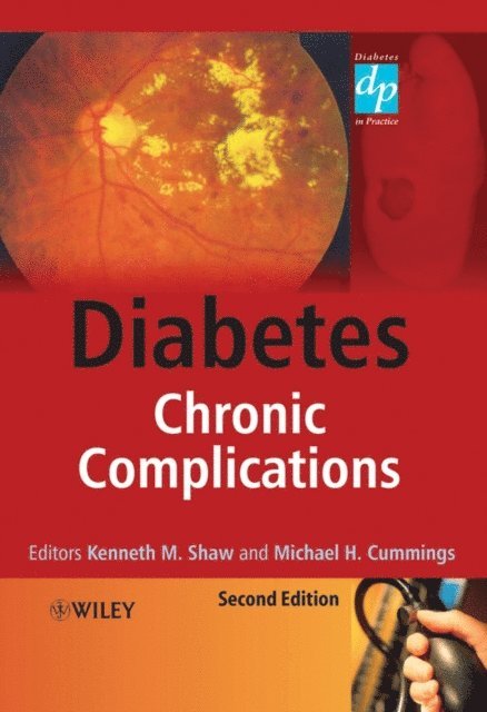 Michael H. Cummings, Kenneth M. Shaw - Diabetes, E-bok