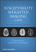 Susceptibility Weighted Imaging in MRI
