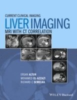 Liver Imaging