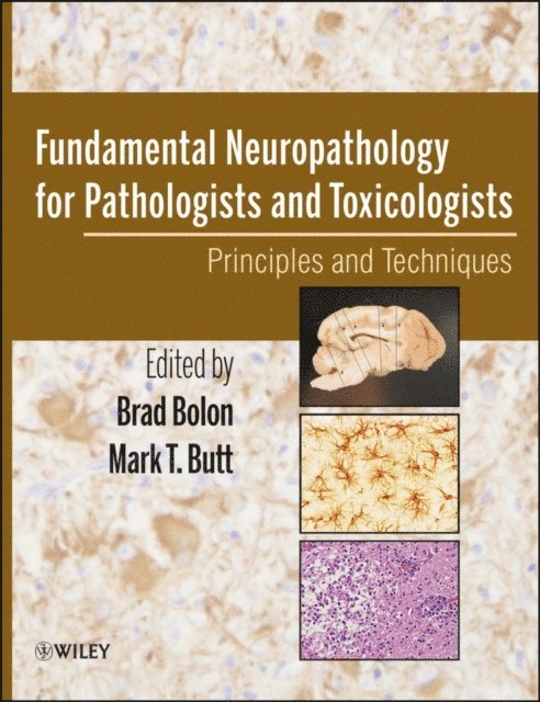 Mark Butt, Brad Bolon - Fundamental Neuropathology for Pathologists and Toxicologists, E-bok