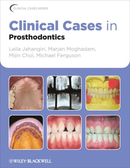 Michael Ferguson, Mijin Choi, Marjan Moghadam, Leila Jahangiri - Clinical Cases in Prosthodontics, E-bok