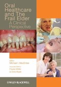 Oral Healthcare and the Frail Elder