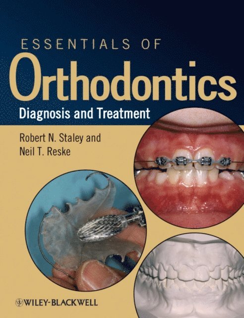 Neil T. Reske, Robert N. Staley - Essentials of Orthodontics, E-bok. Tillgänglighet: Lägg i varukorg