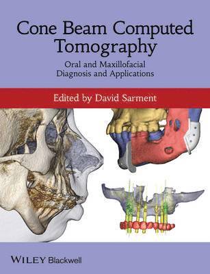 David Sarment - Cone Beam Computed Tomography, Häftad