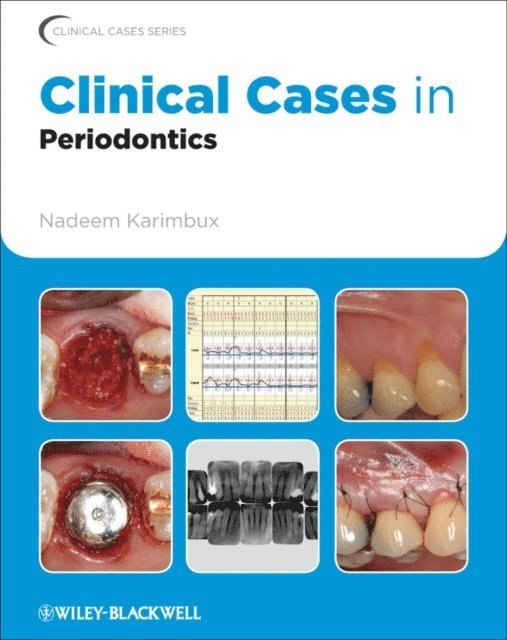 Nadeem Karimbux - Clinical Cases in Periodontics, E-bok