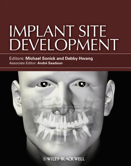 Debby Hwang, Michael Sonick - Implant Site Development, E-bok. Tillgänglighet: Lägg i varukorg