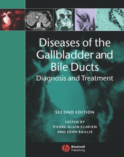 John Baillie, Pierre-Alain Clavien - Diseases of the Gallbladder and Bile Ducts, E-bok