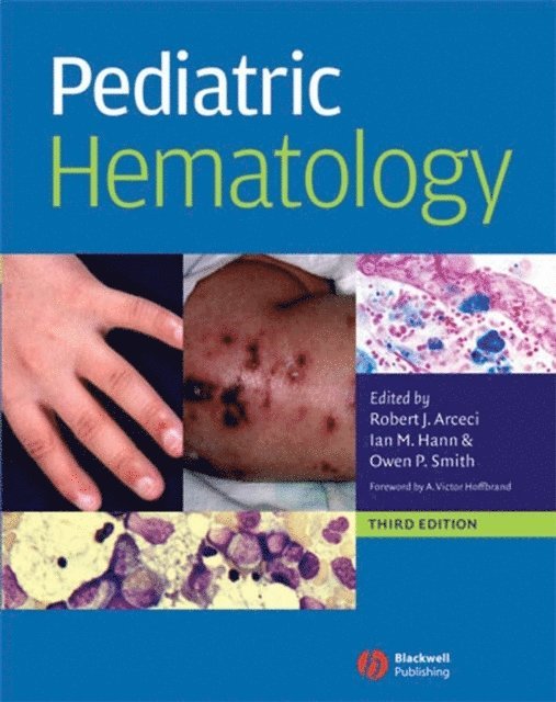 Owen P. Smith, Ian M. Hann, Robert J. Arceci - Pediatric Hematology, E-bok