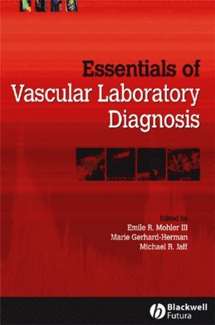 Michael R. Jaff, Marie Gerhard-Herman, Emile R. Mohler - Essentials of Vascular Laboratory Diagnosis, E-bok