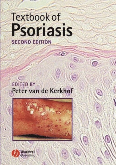 Peter C. M. van de Kerkhof - Textbook of Psoriasis, E-bok