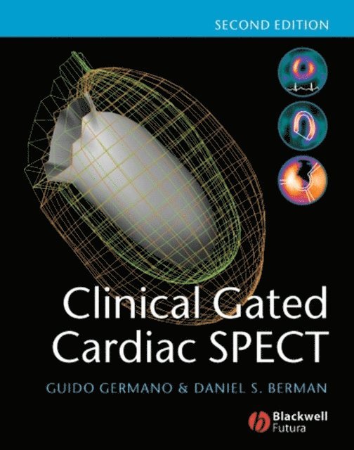 Daniel S. Berman, Guido Germano - Clinical Gated Cardiac SPECT, E-bok