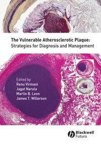 Vulnerable Atherosclerotic Plaque