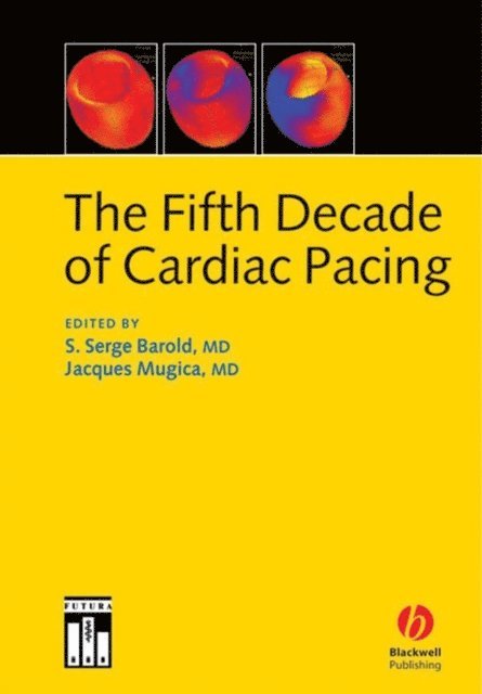 Jacques Mugica, S. Serge Barold - Fifth Decade of Cardiac Pacing, E-bok