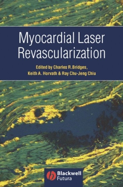 Ray Chu-Jeng Chiu, Keith Horvath, Charles Bridges - Myocardial Laser Revascularization, E-bok