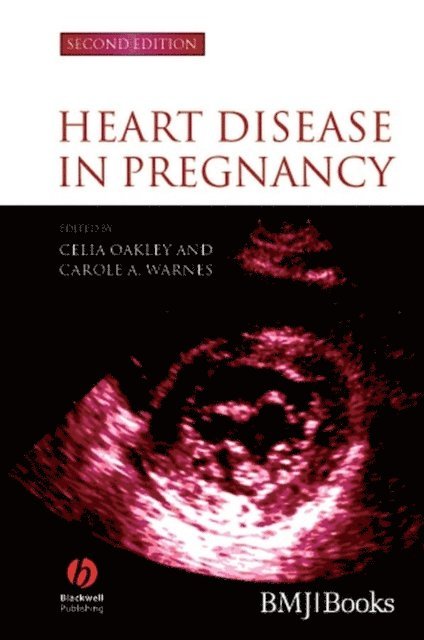 Carole A. Warnes, Celia Oakley - Heart Disease in Pregnancy, E-bok