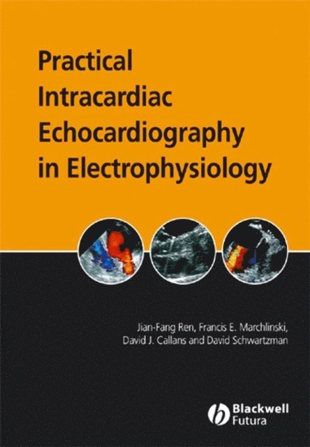David Schwartsman, David J. Callans, Francis E. Marchlinski, Jian-Fang Ren - Practical Intracardiac Echocardiography in Electrophysiology, E-bok