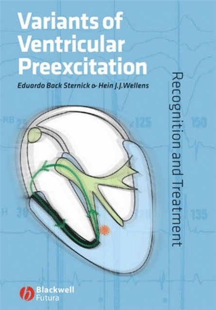 Hein J. J. Wellens, Eduardo Back Sternick - Variants of Ventricular Preexcitation, E-bok
