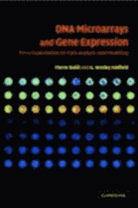 DNA Microarrays and Gene Expression