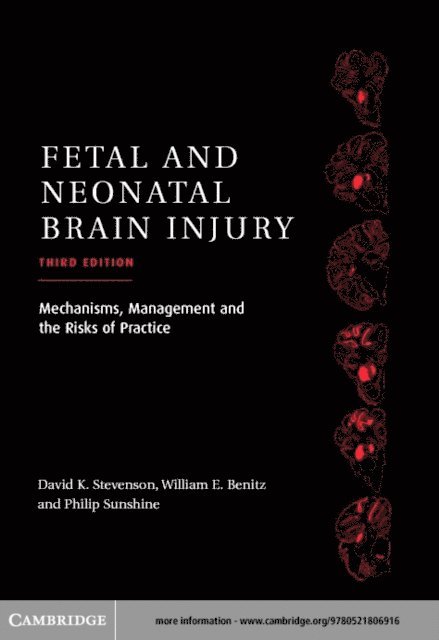 Philip Sunshine, William E. Benitz, David K. Stevenson - Fetal and Neonatal Brain Injury, E-bok