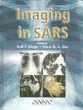 Imaging in SARS