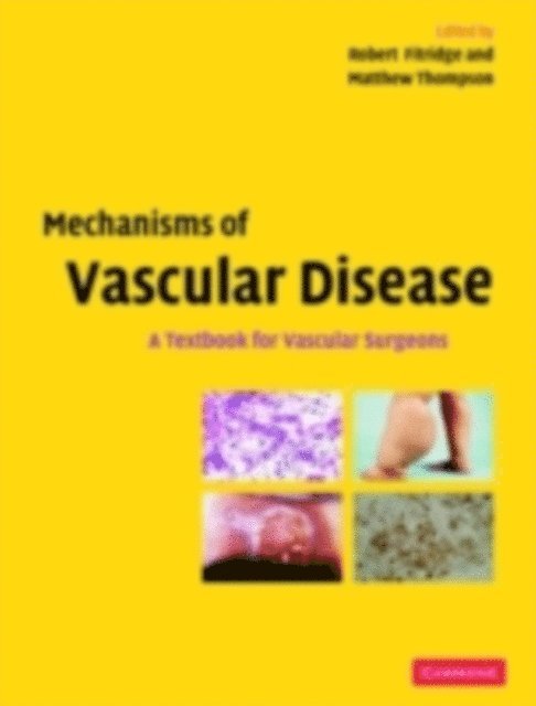 Matthew Thompson, Adelaide) Fitridge, Robert (The Queen Elizabeth Hospital - Mechanisms of Vascular Disease, E-bok