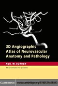 3D Angiographic Atlas of Neurovascular Anatomy and Pathology