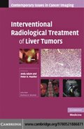 Interventional Radiological Treatment of Liver Tumors