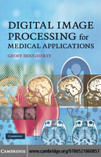 Geoff Dougherty - Digital Image Processing for Medical Applications, E-bok. Tillgänglighet: Lägg i varukorg